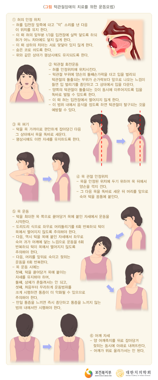 턱관절장애의 치료를 위한 운동요법